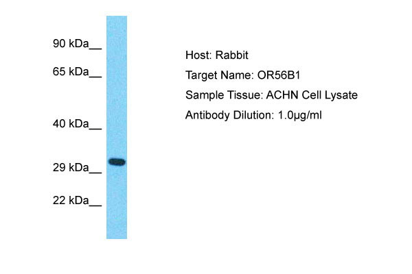 WB - OR56B1 Antibody - middle region AI15948