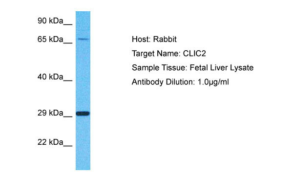 WB - CLIC2 Antibody - N-terminal region AI16144