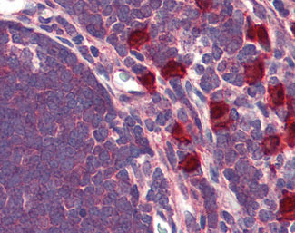 IHC - GPR88 Antibody (Internal) ALS10399