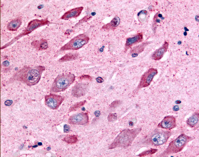 IHC - TAOK1 / TAO1 Antibody (Internal) ALS10882