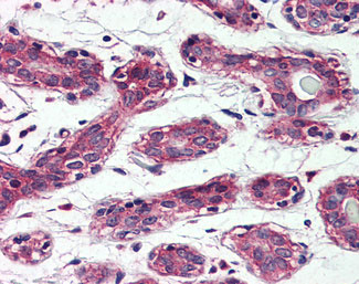 IHC - TAOK1 / TAO1 Antibody (Internal) ALS10919