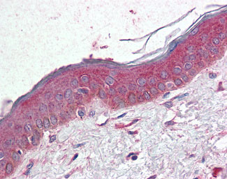 IHC - TM4SF6 / TSPAN6 Antibody (Internal) ALS11013