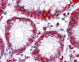 IHC - FKSG89 / MBOAT4 Antibody (Internal) ALS11200