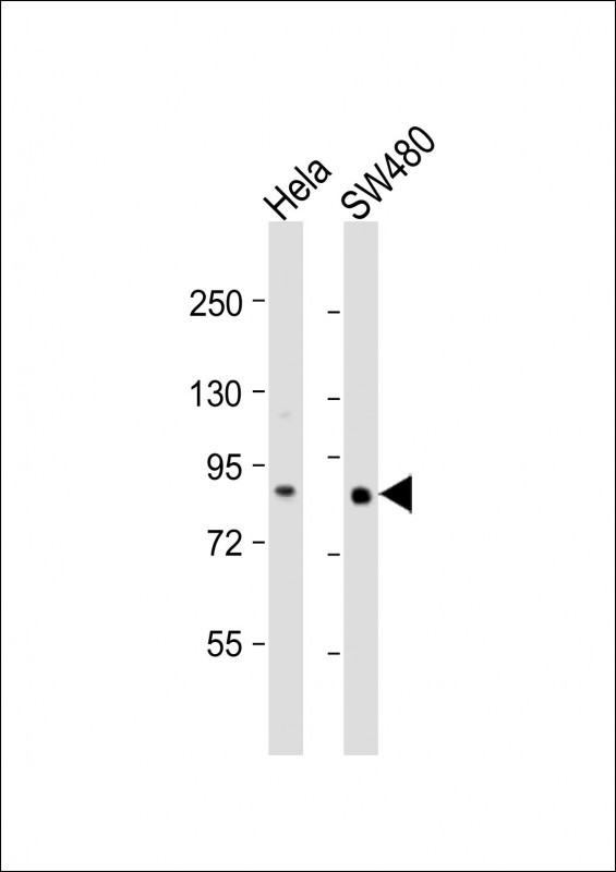 WB - SLCO1B3 Antibody (C-term) AP18964b