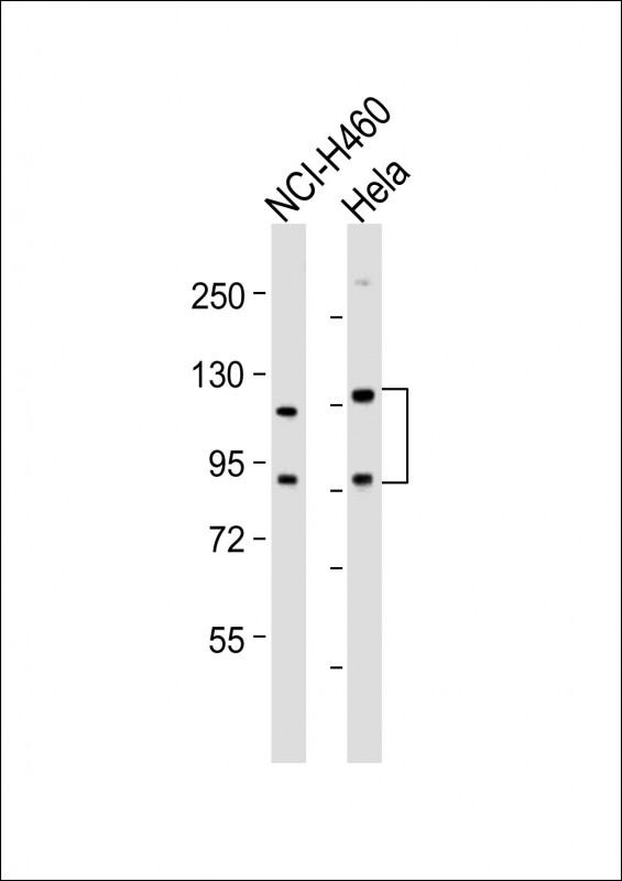 WB - SLCO1B3 Antibody (C-term) AP18964b