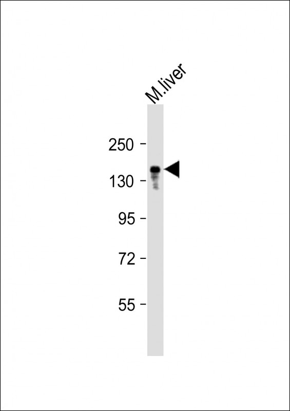 Anti-ABCB11 Antibody (C-term) at 1:2000 dilution + mouse liver lysateLysates/proteins at 20 �g per lane. SecondaryGoat Anti-Rabbit IgG,  (H+L), Peroxidase conjugated at 1/10000 dilution. Predicted band size : 146 kDaBlocking/Dilution buffer: 5% NFDM/TBST.