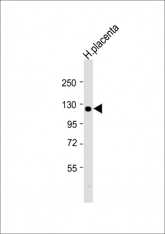 Anti-ITGA2B(Integrin alpha-IIb heavy chain) Antibody (C-term) at 1:2000 dilution + human placenta lysateLysates/proteins at 20 �g per lane. SecondaryGoat Anti-Rabbit IgG,  (H+L), Peroxidase conjugated at 1/10000 dilution. Predicted band size : 113 kDaBlocking/Dilution buffer: 5% NFDM/TBST.