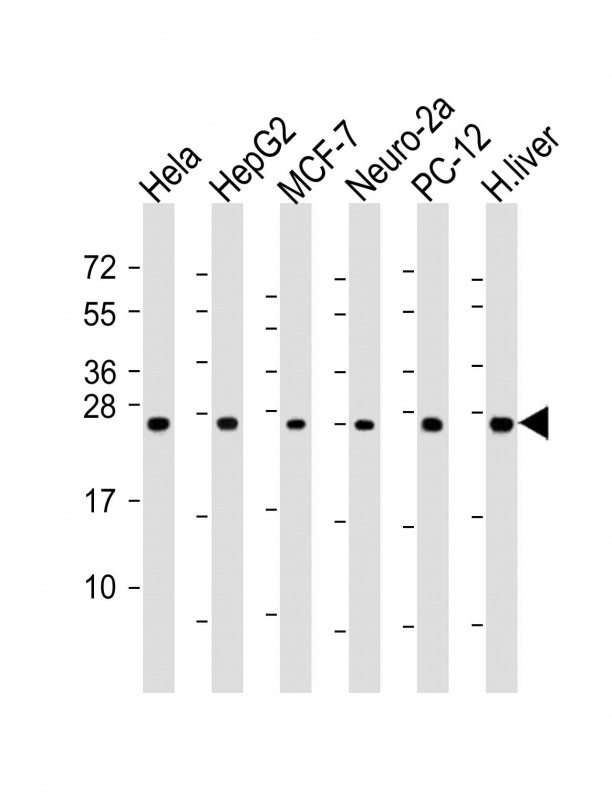 All lanes : Anti-PSMA6 Antibody (N-Term) at 1:2000 dilutionLane 1: Hela whole cell lysateLane 2: HepG2 whole cell lysateLane 3: MCF-7 whole cell lysateLane 4: Neuro-2a whole cell lysateLane 5: PC-12 whole cell lysateLane 6: human liver lysateLysates/proteins at 20 �g per lane. SecondaryGoat Anti-Rabbit IgG,  (H+L), Peroxidase conjugated at 1/10000 dilution. Predicted band size : 27 kDaBlocking/Dilution buffer: 5% NFDM/TBST.