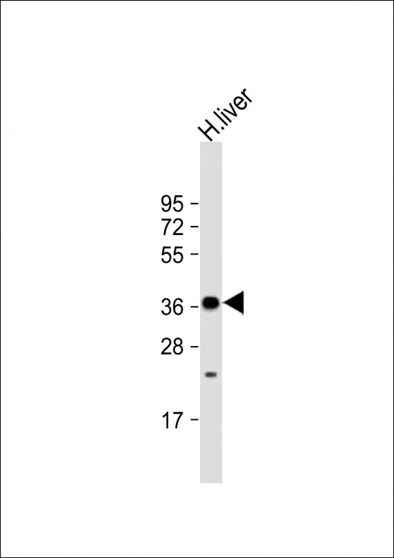 WB - GRHPR Antibody (N-term) AP21687a