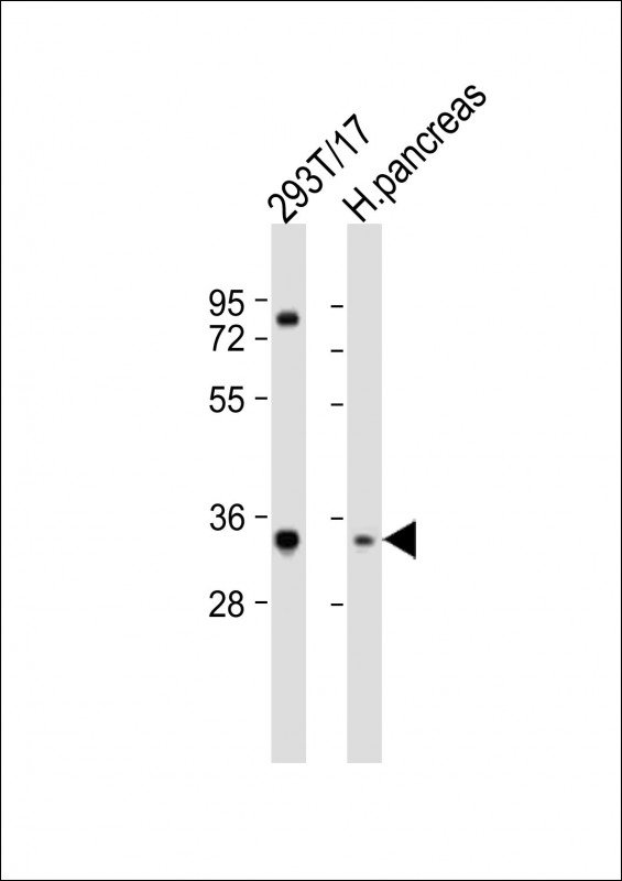 WB - SHOX Antibody (N-term) AP21698a