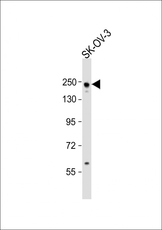 Anti-ARID1A Antibody (C-Term) at 1:2000 dilution + SK-OV-3 whole cell lysateLysates/proteins at 20 �g per lane. SecondaryGoat Anti-Rabbit IgG,  (H+L), Peroxidase conjugated at 1/10000 dilution. Predicted band size : 242 kDaBlocking/Dilution buffer: 5% NFDM/TBST.