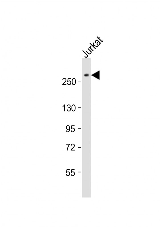 Anti-ARID1A Antibody (C-Term) at 1:2000 dilution + Jurkat whole cell lysateLysates/proteins at 20 �g per lane. SecondaryGoat Anti-Rabbit IgG,  (H+L), Peroxidase conjugated at 1/10000 dilution. Predicted band size : 242 kDaBlocking/Dilution buffer: 5% NFDM/TBST.