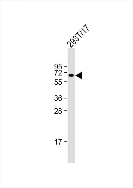 Anti-CDC73 Antibody (Center) at 1:2000 dilution + 293T/17 whole cell lysateLysates/proteins at 20 �g per lane. SecondaryGoat Anti-Rabbit IgG,  (H+L), Peroxidase conjugated at 1/10000 dilution. Predicted band size : 61 kDaBlocking/Dilution buffer: 5% NFDM/TBST.