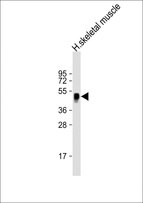 WB - WNT11 Antibody (Center) AP21715c