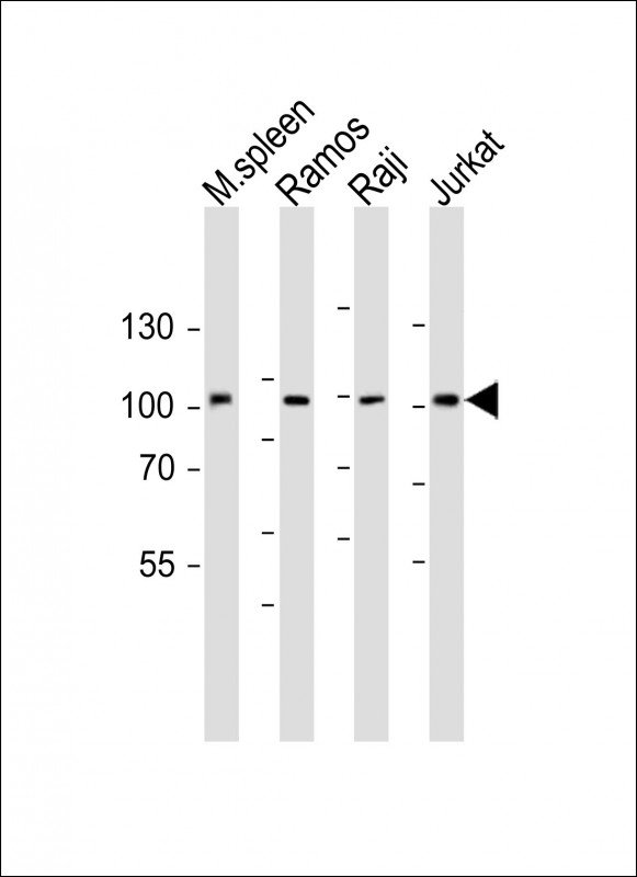 All lanes : Anti-BCL6 Antibody (Center) at 1:1000 dilutionLane 1: mouse spleen lysateLane 2: Ramos whole cell lysateLane 3: Raji whole cell lysateLane 4: Jurkat whole cell lysateLysates/proteins at 20 �g per lane. SecondaryGoat Anti-Rabbit IgG,  (H+L), Peroxidase conjugated at 1/10000 dilution. Predicted band size : 79 kDaBlocking/Dilution buffer: 5% NFDM/TBST.