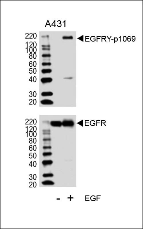Western blot analysis of lysates from A431 cell line, untreated or treated with EGF, 100ng/ml, using EGFRY Antibody ?p1069)(Cat.  #AP3307a)(upper) or EGFR (lower).