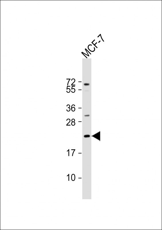 WB - ADM Antibody (Center) AP5006C