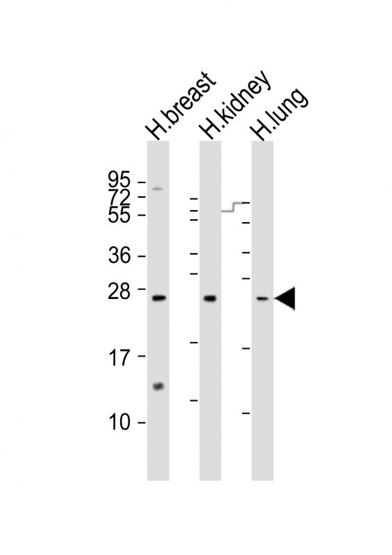 WB - ADM Antibody (Center) AP5006C