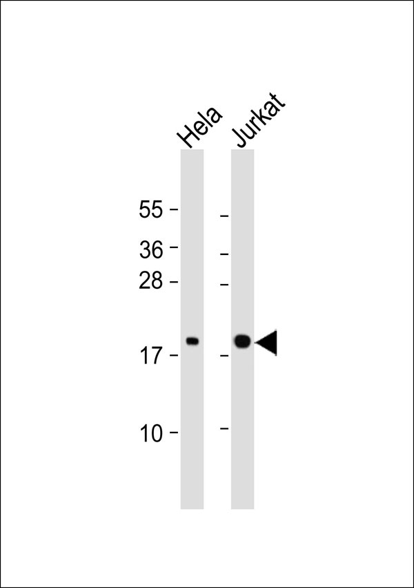 WB - RhoG Antibody AP53317