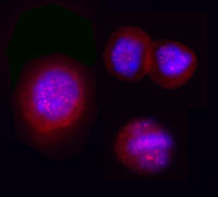 ICC - BRAF / B-Raf Antibody (phospho-Thr598/Ser601) ALS11819
