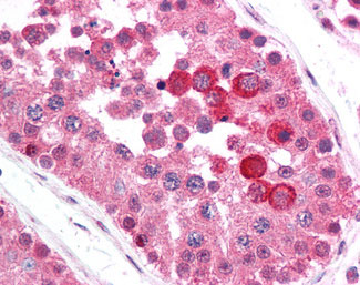 IHC - BRAF / B-Raf Antibody (phospho-Thr598/Ser601) ALS11819