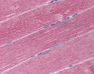 IHC - ADAM17 / TACE Antibody (C-Terminus) ALS11949