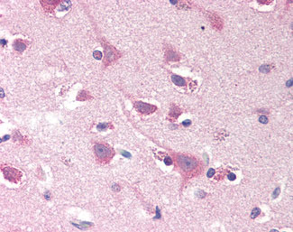 IHC - SMOC2 Antibody (N-Terminus) ALS11962
