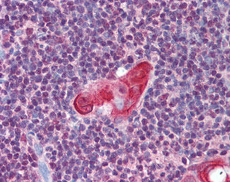 IHC - TLX1 / HOX11 Antibody (aa306-318) ALS12112