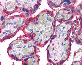 IHC - TGM2 / Transglutaminase 2 Antibody ALS12176