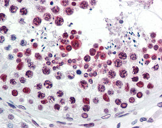 IHC - ATF6 Antibody (C-Terminus) ALS12299