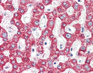 IHC - MCAD / ACADM Antibody (C-Terminus) ALS12597