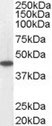 WB - MCAD / ACADM Antibody (C-Terminus) ALS12597
