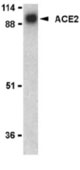 WB - ACE2 / ACE-2 Antibody (N-Terminus) ALS12676