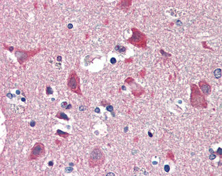 IHC - GUCY1B3 Antibody (aa189-207) ALS12782