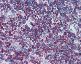 IHC - LCP2 / SLP-76 Antibody (aa216-434) ALS12936