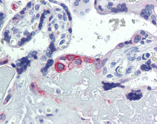 IHC - KRT7 / CK7 / Cytokeratin 7 Antibody (clone 5D12) ALS13036