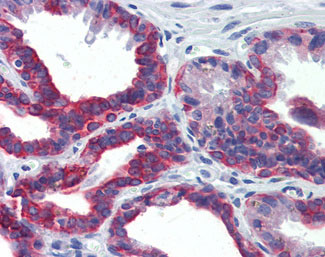 IHC - KRT7 / CK7 / Cytokeratin 7 Antibody (clone 5D12) ALS13036