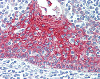 IHC - KRT7 / CK7 / Cytokeratin 7 Antibody (clone 5D12) ALS13036
