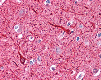 IHC - NEFH / NF-H Antibody (clone NF-05) ALS13469