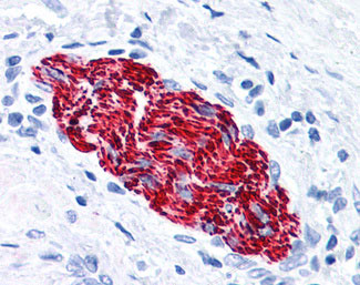 IHC - NEFH / NF-H Antibody (clone NF-05) ALS13469