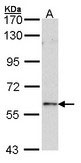 WB - FOXN1 Antibody ALS13641