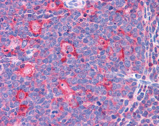 IHC - TPD52L2 / HD54 Antibody (C-Terminus) ALS13703