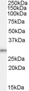 WB - TPD52L2 / HD54 Antibody (C-Terminus) ALS13703