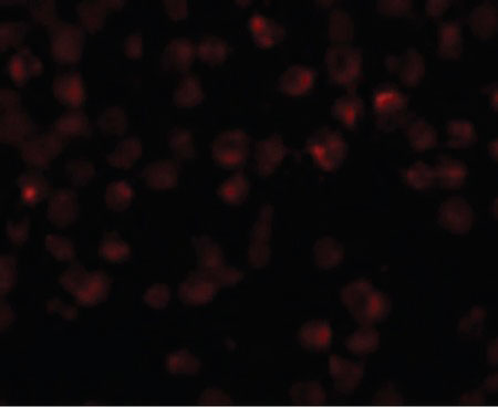IF - NDUFAF2 / NDUFA12L Antibody (C-Terminus) ALS13781