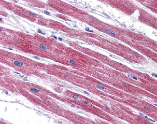 IHC - NDUFAF2 / NDUFA12L Antibody (C-Terminus) ALS13781