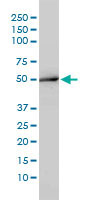 WB - ACY1 / Aminoacylase 1 Antibody (clone 4F1-B7) ALS14019
