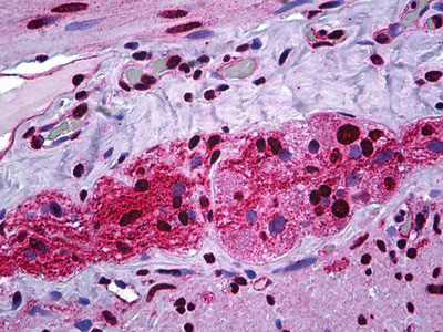 IHC - STAT1 Antibody (phospho-Ser727) ALS14185