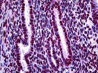 IHC - STAT1 Antibody (phospho-Ser727) ALS14185