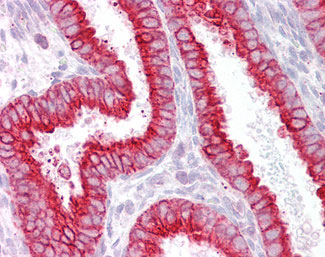 IHC - CHRNB4 Antibody (Internal) ALS14570
