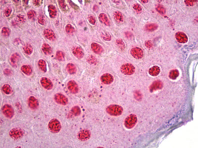 IHC - HDAC2 Antibody (aa360-409) ALS14676